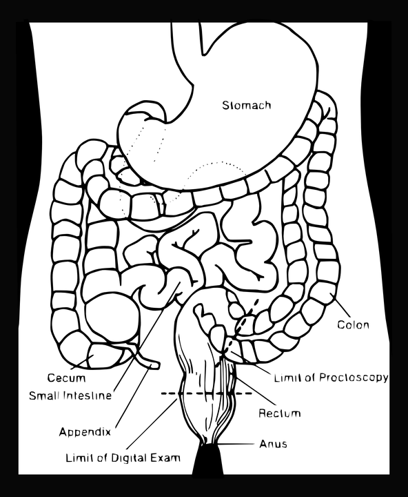 פוליפים במעי הגס